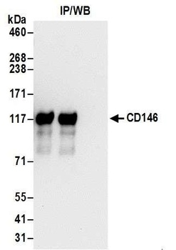 Rabbit CD146 Antibody
