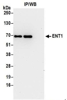 Rabbit ENT1 Antibody