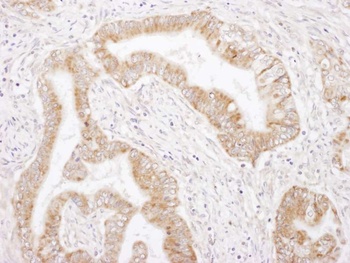 Rabbit anti-Rictor Antibody