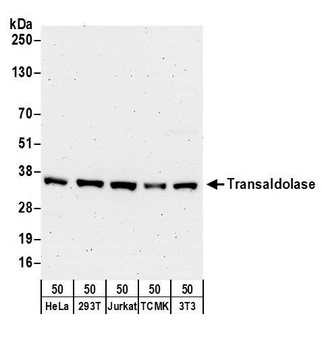 Rabbit Transaldolase Antibody