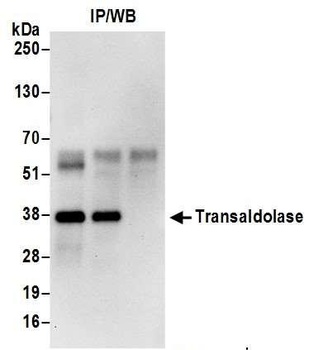 Transaldolase Antibody