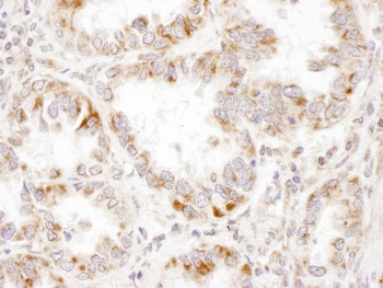 PCCA Antibody