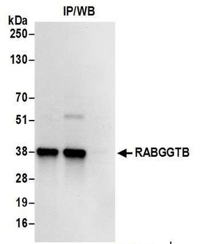 Rabbit anti-RABGGTB Antibody