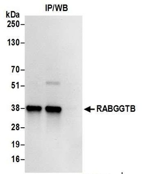 RABGGTB Antibody