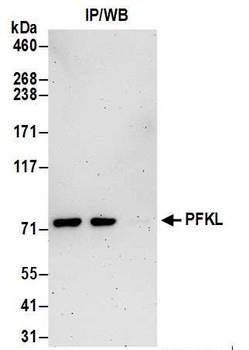 PFKL Antibody