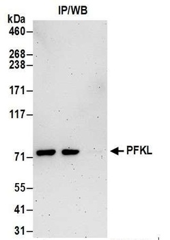 Rabbit PFKL Antibody
