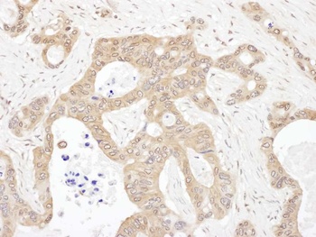 Rabbit anti-LARS Antibody