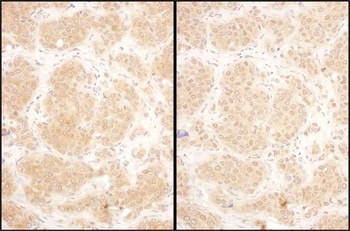 Rabbit anti-GART Antibody