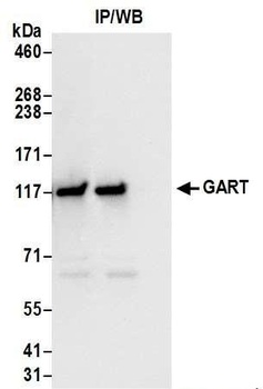 GART Antibody