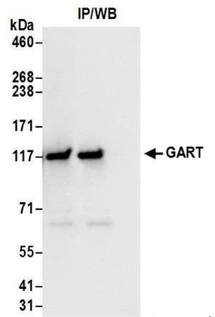 Rabbit anti-GART Antibody