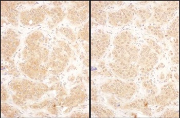 Rabbit anti-GART Antibody
