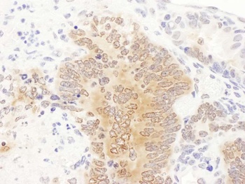 Rabbit anti-GART Antibody