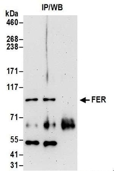 Rabbit FER Antibody