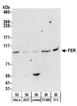 Rabbit FER Antibody