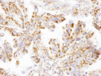 DLST Antibody