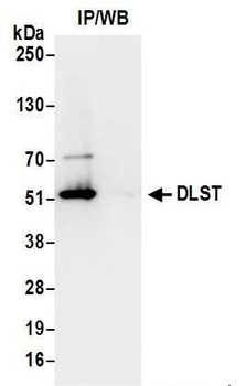 Rabbit anti-DLST Antibody
