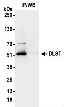 DLST Antibody