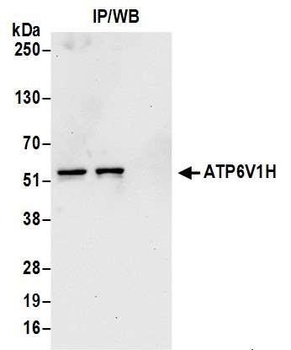 ATP6V1H Antibody