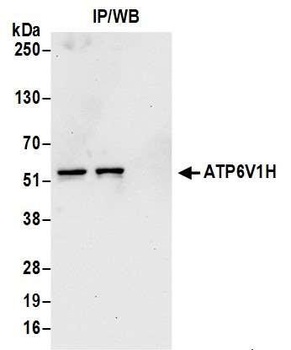 Rabbit anti-ATP6V1H Antibody