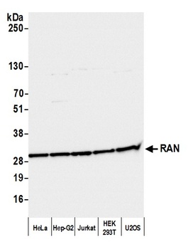 Rabbit anti-RAN Antibody