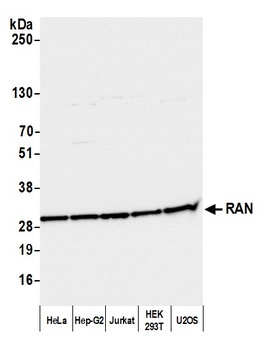 RAN Antibody