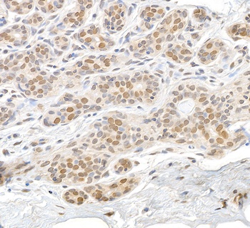 Rabbit anti-RAN Antibody