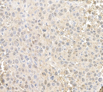 Rabbit anti-RAN Antibody