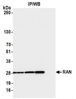 RAN Antibody