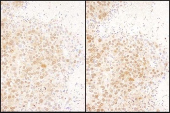 Rabbit anti-RAN Antibody