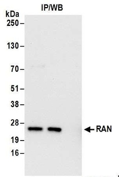 RAN Antibody