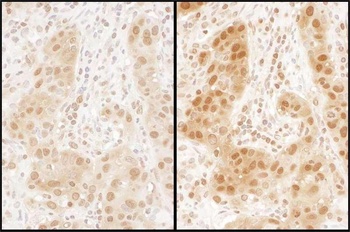Rabbit anti-RAN Antibody