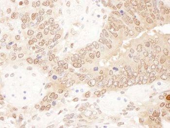 ACAT2 Antibody