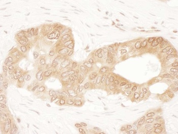 Rabbit anti-ACAT2 Antibody