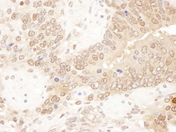 Rabbit anti-ACAT2 Antibody