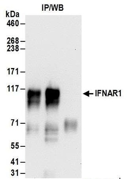 Rabbit anti-IFNAR1 Antibody