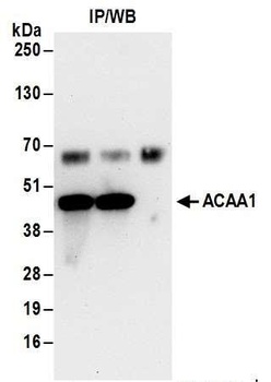 Rabbit anti-ACAA1 Antibody