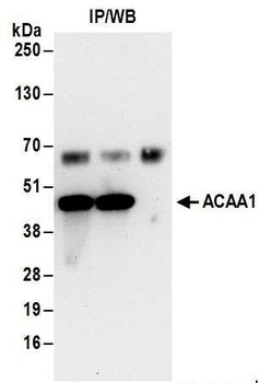 ACAA1 Antibody