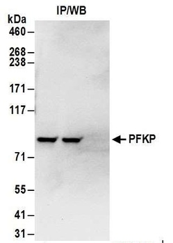 Rabbit PFKP Antibody