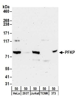 Rabbit PFKP Antibody