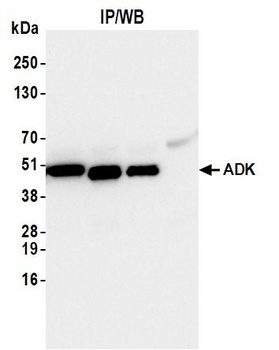 ADK Antibody