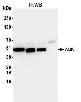 Rabbit anti-ADK Antibody