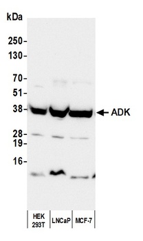 Rabbit anti-ADK Antibody