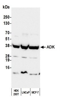 ADK Antibody