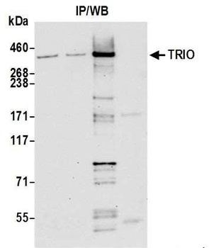 Rabbit anti-TRIO Antibody