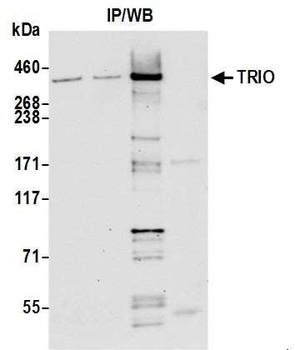 TRIO Antibody