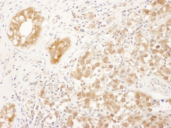 Rabbit anti-FNTA Antibody