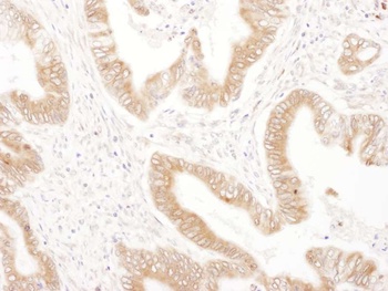 Rabbit anti-RPN2 Antibody
