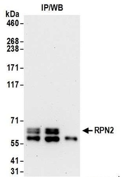 Rabbit anti-RPN2 Antibody