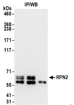 RPN2 Antibody