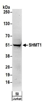 Rabbit anti-SHMT1 Antibody